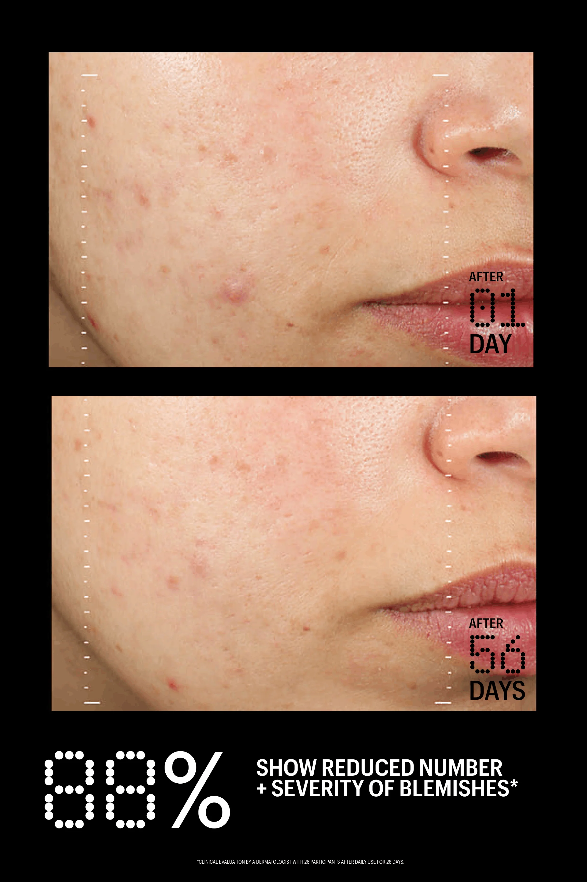 Azelaic & Kojic Advanced Clarifying Serum - Image 14