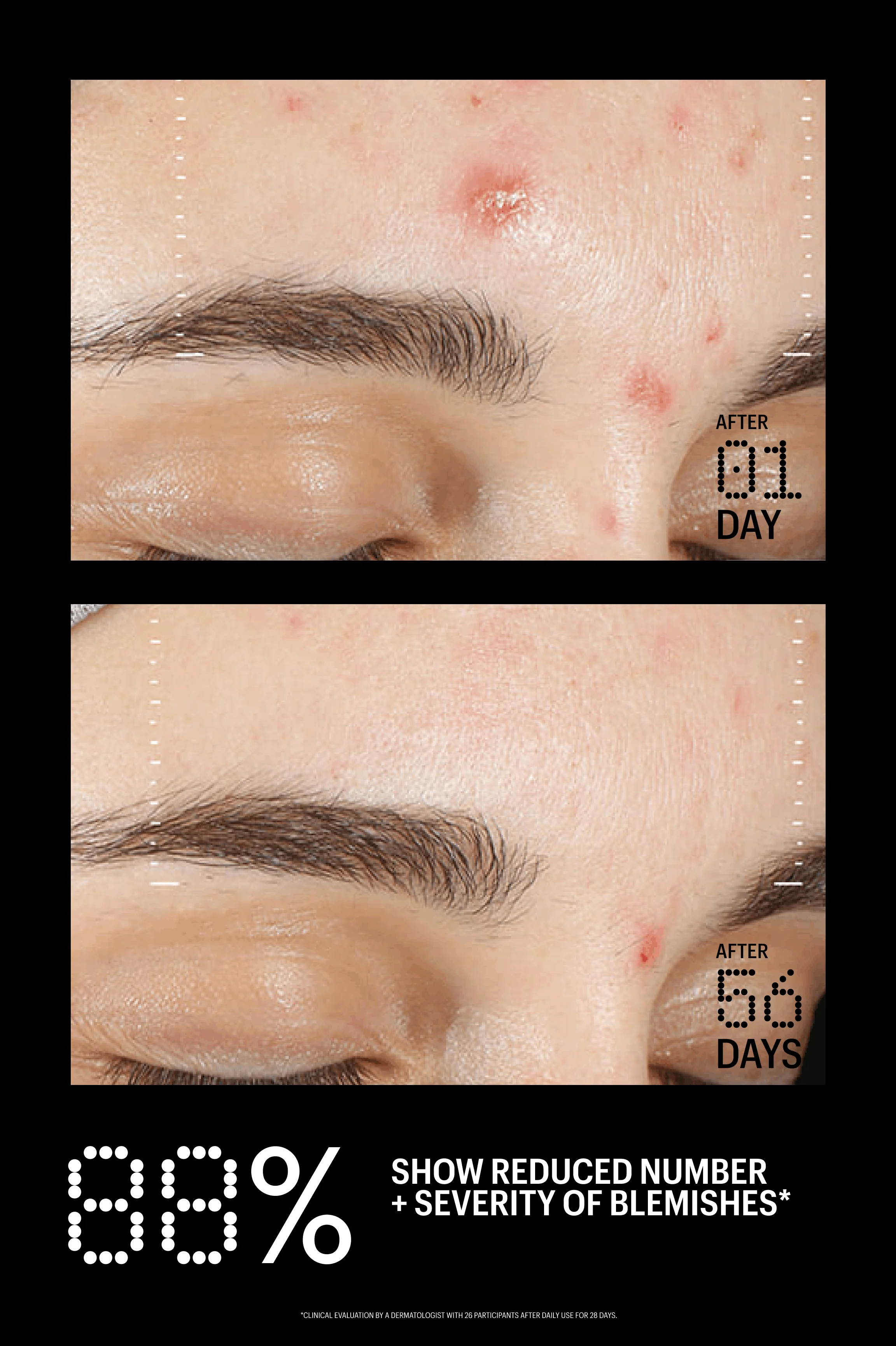 Azelaic & Kojic Advanced Clarifying Serum - Image 15