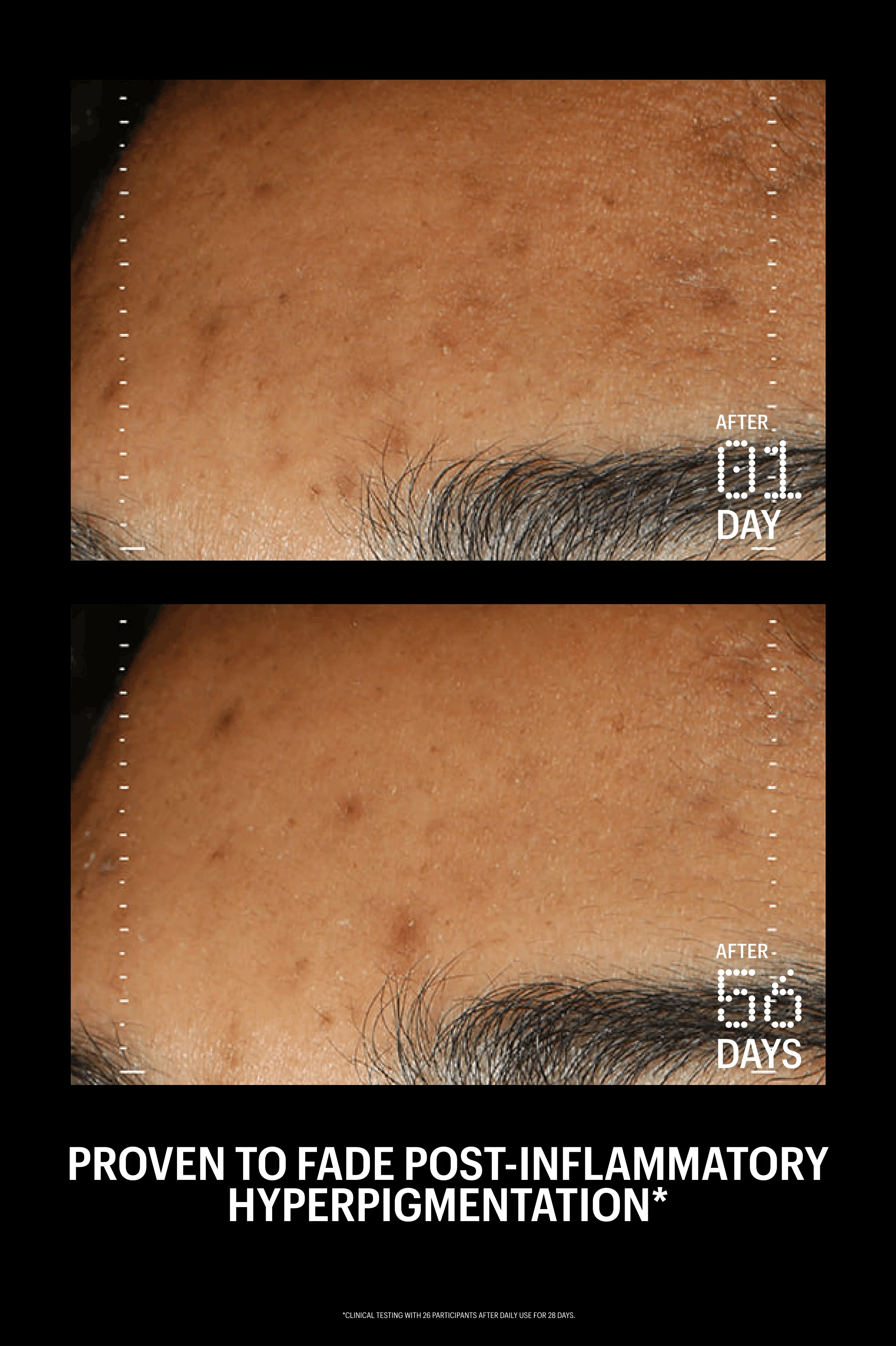 Azelaic & Kojic Advanced Clarifying Serum - Image 11