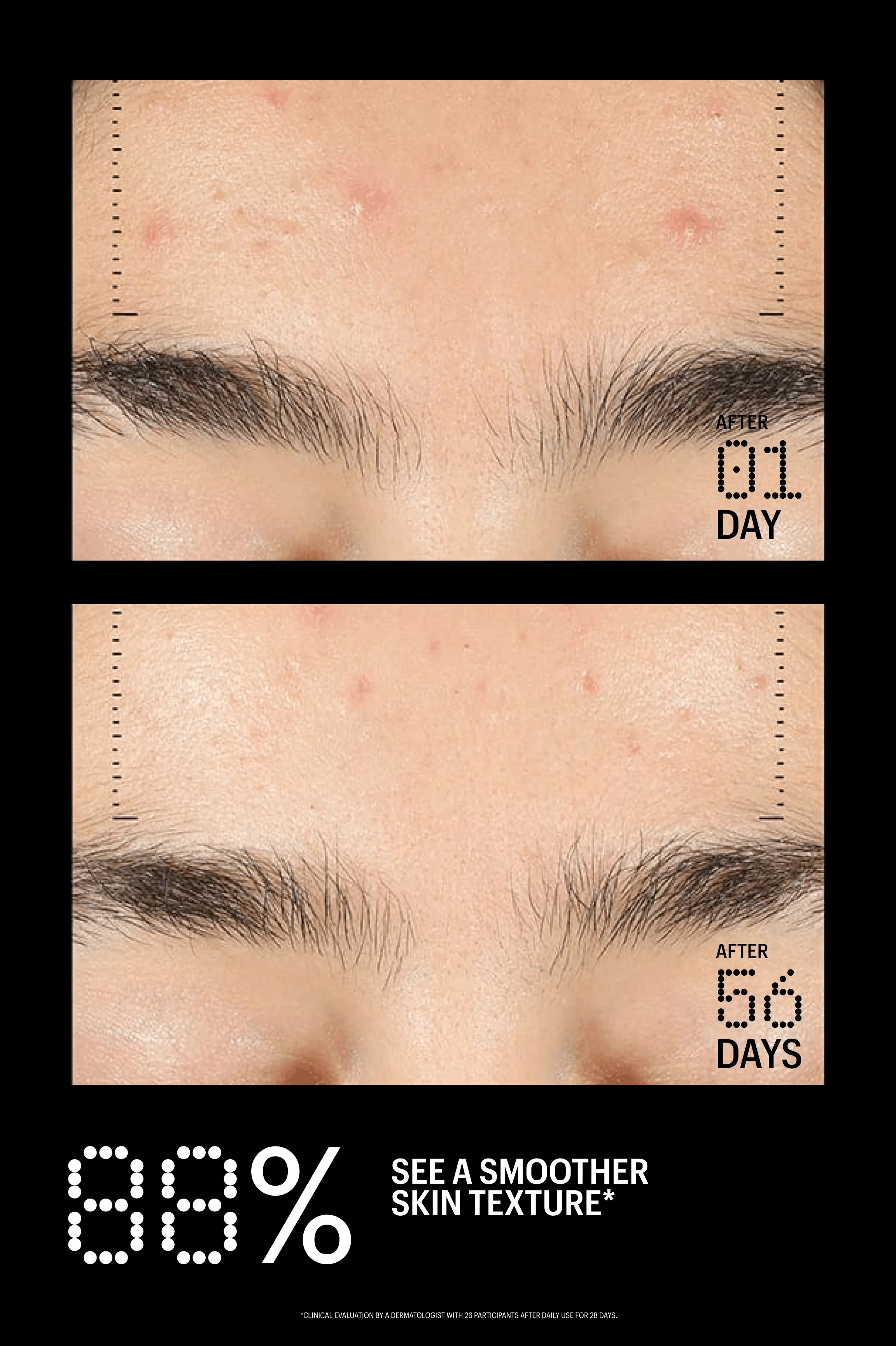 Azelaic & Kojic Advanced Clarifying Serum - Image 12